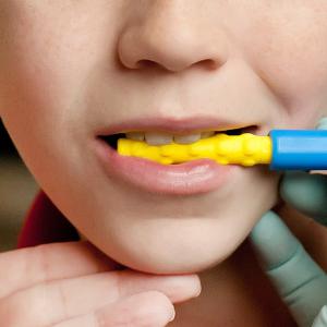 ARK Texturált Harapáscső eszközvég XL